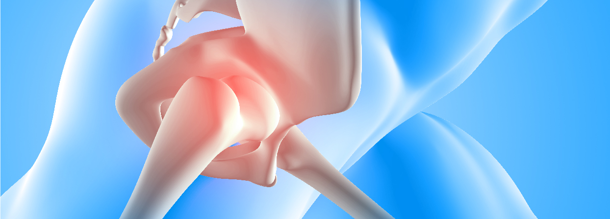 Minimally Invasive Knee Hip Replacement Surgery Rbh