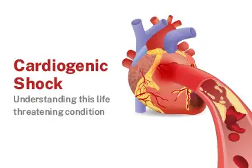 Cardiogenic shock: Understanding this life-threatening condition - BMB