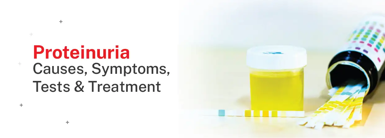 Protein in Urine (Proteinuria) Causes, Symptoms, Tests & Treatments