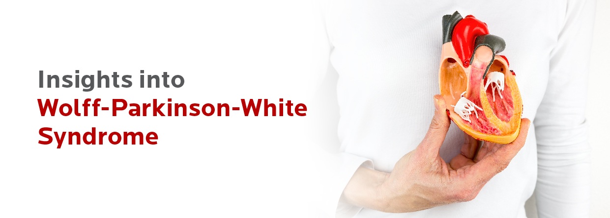 Wolff-Parkinson-White Syndrome: Causes, Symptoms & Treatment