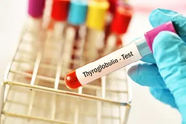 Thyroglobulin Test Results Explained: What Your Numbers Mean